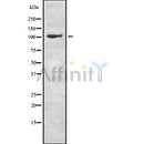 DF8069 at 1/100 staining Mouse kidney tissue by IHC-P. The sample was formaldehyde fixed and a heat mediated antigen retrieval step in citrate buffer was performed. The sample was then blocked and incubated with the antibody for 1.5 hours at 22¡ãC. An HRP conjugated goat anti-rabbit antibody was used as the secondary