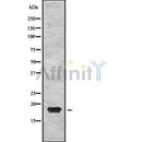 DF8076 at 1/100 staining Human prostate tissue by IHC-P. The sample was formaldehyde fixed and a heat mediated antigen retrieval step in citrate buffer was performed. The sample was then blocked and incubated with the antibody for 1.5 hours at 22¡ãC. An HRP conjugated goat anti-rabbit antibody was used as the secondary