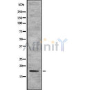 Western blot analysis of extracts from mouse kidney,rat brain,mouse brian, using TSLP Antibody.