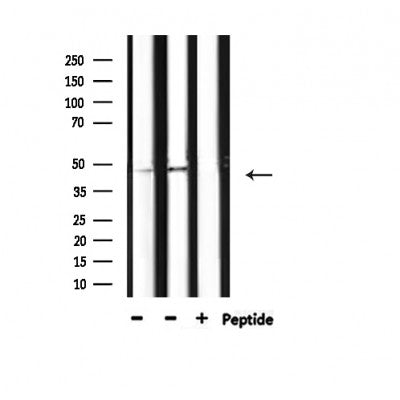 Western blot analysis of extracts from various samples, using Phospho-HDAC3 (Ser424) Antibody.
 Lane 1: Mouse brain treated with blocking peptide;
 Lane 2: Mouse brain;
Lane 3: 3T3;
Lane 4: HepG2;
Lane 5: HeLa.