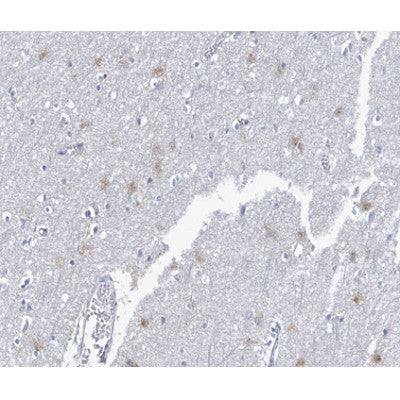 AF0182 at 1/100 staining human brain tissue sections by IHC-P. The tissue was formaldehyde fixed and a heat mediated antigen retrieval step in citrate buffer was performed. The tissue was then blocked and incubated with the antibody for 1.5 hours at 22¡ãC. An HRP conjugated goat anti-rabbit antibody was used as the secondary