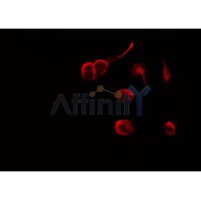 AF0182 staining SKOV3 by IF/ICC. The sample were fixed with PFA and permeabilized in 0.1% Triton X-100,then blocked in 10% serum for 45 minutes at 25¡ãC. The primary antibody was diluted at 1/200 and incubated with the sample for 1 hour at 37¡ãC. An  Alexa Fluor 594 conjugated goat anti-rabbit IgG (H+L) Ab, diluted at 1/600, was used as the secondary antibod