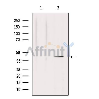 Western blot analysis of extracts from HepG2, using NRG1 isoform-10 Antibody. Lane 1 was treated with the antigen-specific peptide.