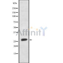 Western blot analysis FRAT1 using Jurkat whole cell lysates