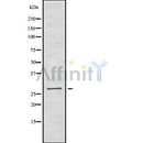 Western blot analysis ING4 using Jurkat whole cell lysates