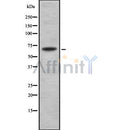 Western blot analysis of TRIP10 using HuvEc whole cell lysates