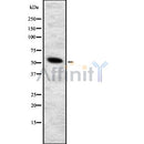Western blot analysis GRB7 using COLO205 whole cell lysates