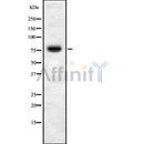 Western blot analysis STIM1 using HT29 whole cell lysates