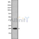Western blot analysis of CD3G using HT29 whole cell lysates