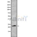 Western blot analysis of CLEC3B using HepG2 whole cell lysates