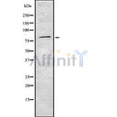 DF8106 staining Hela by IF/ICC. The samples were fixed with PFA and permeabilized in 0.1% Triton X-100,then blocked in 10% serum for 45 minutes at 25¡ãC. Samples were then incubated with primary Ab(AF8106 1:100) and mouse anti-beta tubulin Ab(T0023 1:200) for 1 hour at 37¡ãC. An  AlexaFluor594 conjugated goat anti-rabbit IgG(H+L) Ab(S0006 1:100 Red) and an AlexaFluor488 conjugated goat anti-mouse IgG(H+L) Ab(S0017 1:600 Green) were used as the secondary antibody.