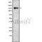 Western blot analysis of RSF1 using Jurkat whole cell lysates