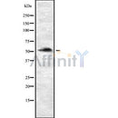 Western blot analysis of P4HTM using Jurkat whole cell lysates