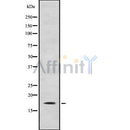 Western blot analysis of CITED4 using K562 whole cell lysates