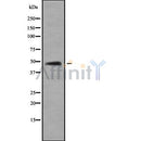 DF8118 at 1/100 staining Human gastric tissue by IHC-P. The sample was formaldehyde fixed and a heat mediated antigen retrieval step in citrate buffer was performed. The sample was then blocked and incubated with the antibody for 1.5 hours at 22¡ãC. An HRP conjugated goat anti-rabbit antibody was used as the secondary