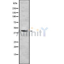 Western blot analysis FNTA using COLO205 whole cell lysates