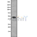 Western blot analysis of PIP4K2A using COLO205 whole cell lysates