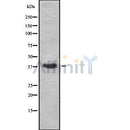 DF8129 at 1/100 staining Human kidney tissue by IHC-P. The sample was formaldehyde fixed and a heat mediated antigen retrieval step in citrate buffer was performed. The sample was then blocked and incubated with the antibody for 1.5 hours at 22¡ãC. An HRP conjugated goat anti-rabbit antibody was used as the secondary