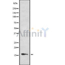 Western blot analysis of PTS using HuvEc whole cell lysates