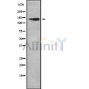 Western blot analysis of CDH4 using Jurkat whole cell lysates
