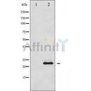 Western blot analysis of extracts from various samples, using SOCS2 Antibody. Lane 1: 293  treated with  blocking peptide; Lane 2: 293; Lane 3: mouse brain; Lane 4: hela; 