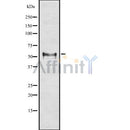 DF8134 staining HepG2 by IF/ICC. The sample were fixed with PFA and permeabilized in 0.1% Triton X-100,then blocked in 10% serum for 45 minutes at 25¡ãC. The primary antibody was diluted at 1/200 and incubated with the sample for 1 hour at 37¡ãC. An  Alexa Fluor 594 conjugated goat anti-rabbit IgG (H+L) Ab, diluted at 1/600, was used as the secondary antibod