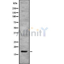 DF8136 at 1/100 staining Human prostate tissue by IHC-P. The sample was formaldehyde fixed and a heat mediated antigen retrieval step in citrate buffer was performed. The sample was then blocked and incubated with the antibody for 1.5 hours at 22¡ãC. An HRP conjugated goat anti-rabbit antibody was used as the secondary