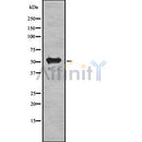 DF8147 staining HepG2 by IF/ICC. The sample were fixed with PFA and permeabilized in 0.1% Triton X-100,then blocked in 10% serum for 45 minutes at 25¡ãC. The primary antibody was diluted at 1/200 and incubated with the sample for 1 hour at 37¡ãC. An  Alexa Fluor 594 conjugated goat anti-rabbit IgG (H+L) Ab, diluted at 1/600, was used as the secondary antibod
