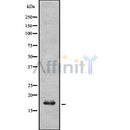 Western blot analysis UBE2L6 using K562 whole cell lysates