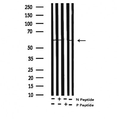 Western blot analysis of Phospho-p56 Dok-2 (Tyr299) expression in various lysates