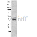 Western blot analysis of CD7 using Jurkat whole cell lysates