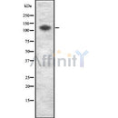 Western blot analysis UNC13D using HepG2 whole cell lysates
