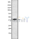 DF8164 staining HepG2 by IF/ICC. The sample were fixed with PFA and permeabilized in 0.1% Triton X-100,then blocked in 10% serum for 45 minutes at 25¡ãC. The primary antibody was diluted at 1/200 and incubated with the sample for 1 hour at 37¡ãC. An  Alexa Fluor 594 conjugated goat anti-rabbit IgG (H+L) Ab, diluted at 1/600, was used as the secondary antibod