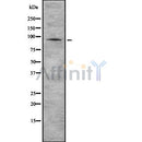 Western blot analysis of PI4KB using COLO205 whole cell lysates