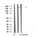 Western blot analysis of A2M using K562 whole cell lysates