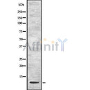 Western blot analysis of extracts from MCF7, using UFM1 Antibody. The lane on the left was treated with blocking peptide.