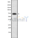 Western blot analysis of ZBTB33 using COLO205 whole cell lysates