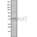 DF8189 at 1/100 staining Human Melanoma tissue by IHC-P. The sample was formaldehyde fixed and a heat mediated antigen retrieval step in citrate buffer was performed. The sample was then blocked and incubated with the antibody for 1.5 hours at 22¡ãC. An HRP conjugated goat anti-rabbit antibody was used as the secondary