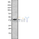 DF8191 staining Hela by IF/ICC. The sample were fixed with PFA and permeabilized in 0.1% Triton X-100,then blocked in 10% serum for 45 minutes at 25¡ãC. The primary antibody was diluted at 1/200 and incubated with the sample for 1 hour at 37¡ãC. An  Alexa Fluor 594 conjugated goat anti-rabbit IgG (H+L) Ab, diluted at 1/600, was used as the secondary antibod
