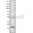 Western blot analysis UBE2N using K562 whole cell lysates