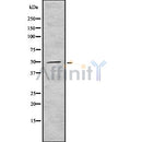 DF8196 at 1/100 staining Human liver tissue by IHC-P. The sample was formaldehyde fixed and a heat mediated antigen retrieval step in citrate buffer was performed. The sample was then blocked and incubated with the antibody for 1.5 hours at 22¡ãC. An HRP conjugated goat anti-rabbit antibody was used as the secondary