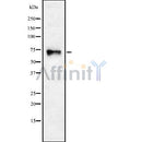 Western blot analysis of CHRNA4 using HuvEc whole cell lysates