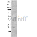 Western blot analysis of PTRH2 using COLO205 whole cell lysates