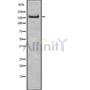 Western blot analysis UGGT1 using COLO205 whole cell lysates
