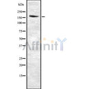 Western blot analysis SCRIB using HepG2 whole cell lysates