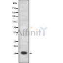 Western blot analysis of extracts from Rat lung, using PLA2G1B Antibody. The lane on the left was treated with blocking peptide.