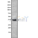 Western blot analysis of DAZL using Jurkat whole cell lysates
