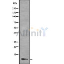 Western blot analysis of MLLT11 using COLO205 whole cell lysates
