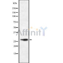 Western blot analysis of CD48 using HeLa whole cell lysates