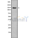 DF8223 at 1/100 staining Human kidney tissue by IHC-P. The sample was formaldehyde fixed and a heat mediated antigen retrieval step in citrate buffer was performed. The sample was then blocked and incubated with the antibody for 1.5 hours at 22¡ãC. An HRP conjugated goat anti-rabbit antibody was used as the secondary